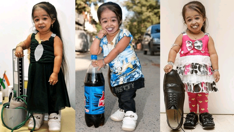 Strange looking people - Jyoti Amge shoe size 